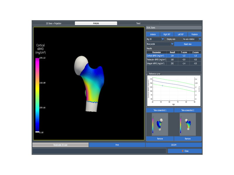 pro 6.2